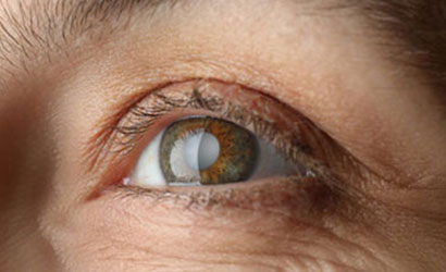 Cataract Treatment